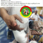 கரூர் ராஜேந்திரன் ஆள்காட்டி விரலில் உள்ள நகம் ஒடிந்ததாம்!