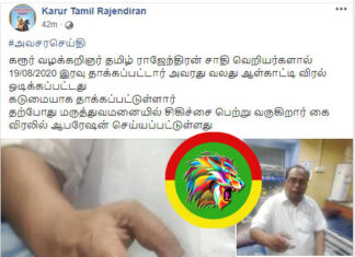 கரூர் ராஜேந்திரன் ஆள்காட்டி விரலில் உள்ள நகம் ஒடிந்ததாம்!